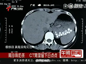 圖片來源：廣東衛視