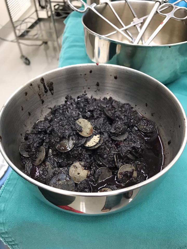 圖片來源:Dr. Nantarika Chansue/Facebook